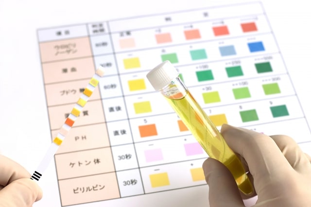 糖尿病と尿の泡立ち - その関係性について