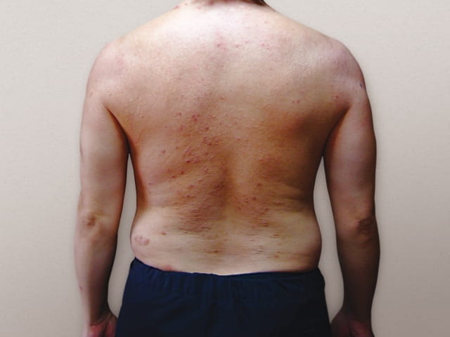 背中・腰・お腹・脇腹ごとの症状の特徴